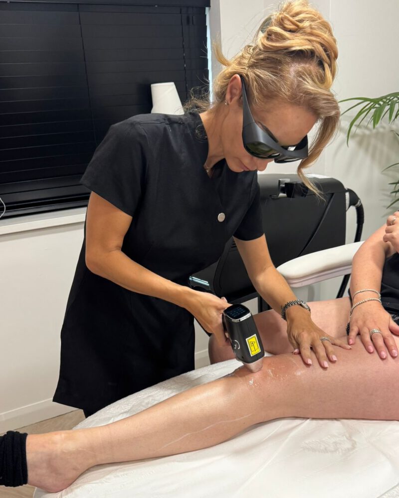 Laser Hair Removal treatment at Chemist Aesthetics, Liverpool